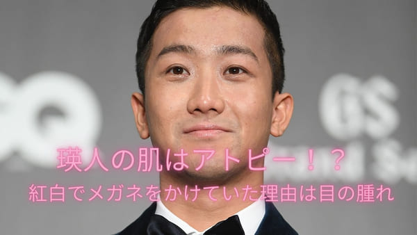 画像 瑛人の肌はアトピー 紅白でメガネをかけた理由は目の腫れを隠すため
